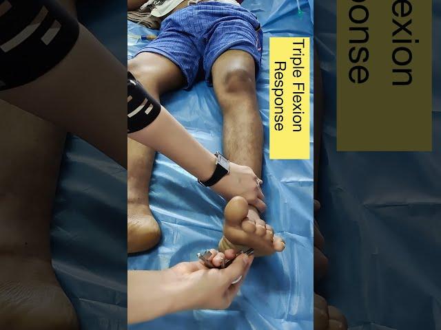 babinski with triple flexion response |  complete extensor planatar reflex  #neurology #shorts