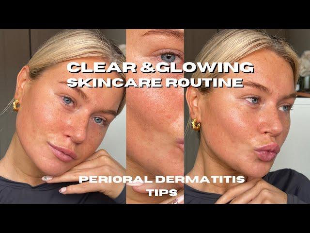 MORNING & NIGHT SKINCARE ROUTINE!! PERIORAL DERMATITIS TIPS | GLOWING SKIN | BIRTH CONTROL PILL SKIN