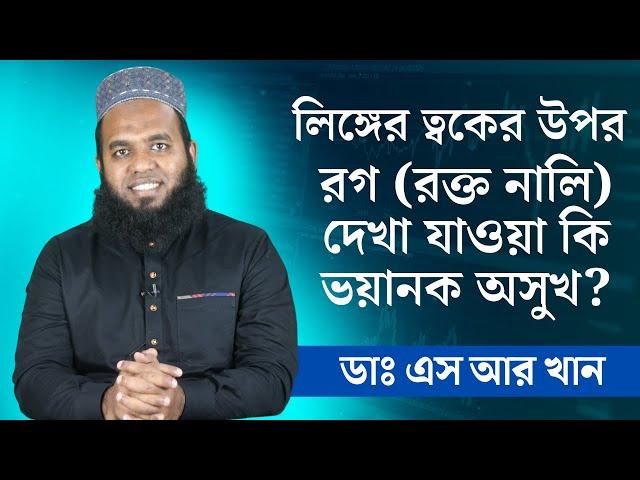 লিঙ্গের ত্বকের উপর রগ রক্ত নালি দেখা যাওয়া কি ভয়ানক অসুখ? #ডাএসআরখান || #DrSRKhan