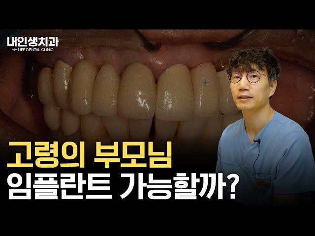 고령의 부모님 임플란트 가능할까? , 노인 임플란트, 내인생치과