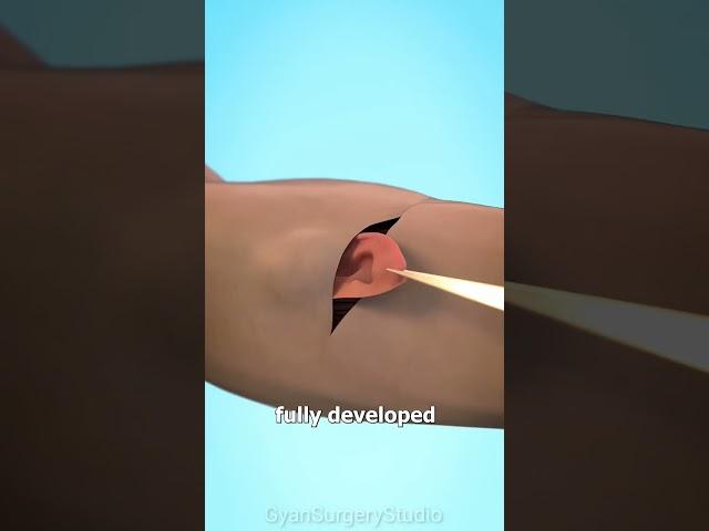 What happens if your ear is cut off?(3D Animation) #shorts #science #3danimation #hindi