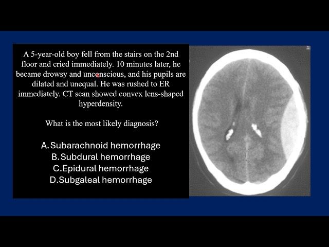 Pediatric Neurology Lecture Preview