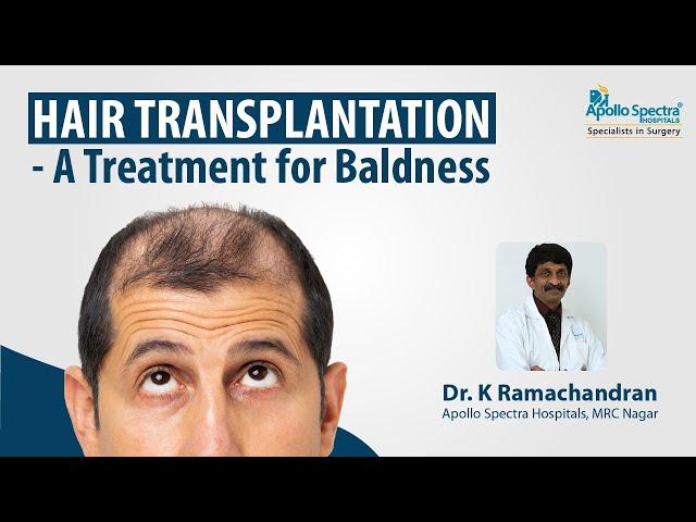 Hair Transplant – Effects & Treatments.