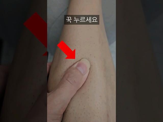 이거 신장이 죽어가는 신호입니다 (당장 확인하세요)