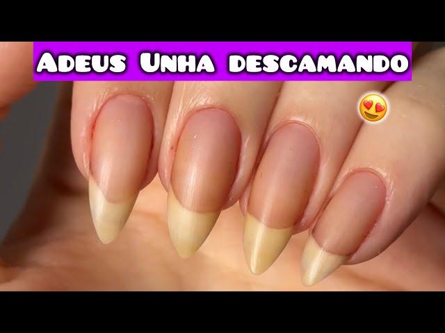 UNHAS DESCAMANDO: O QUE FAZER? SOLUÇÕES COMPLETAS