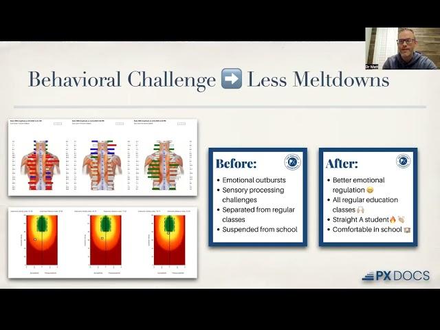 how we measure the overwhelm to help calm the nervous system