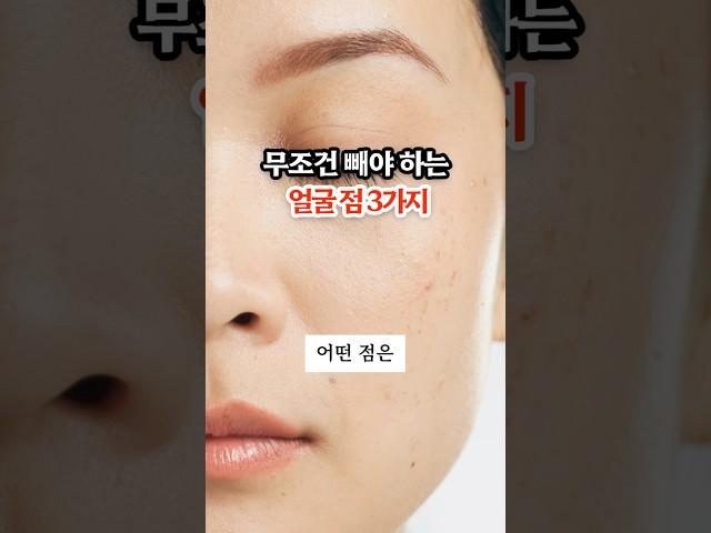 무조건 빼야 하는 얼굴 점 3가지