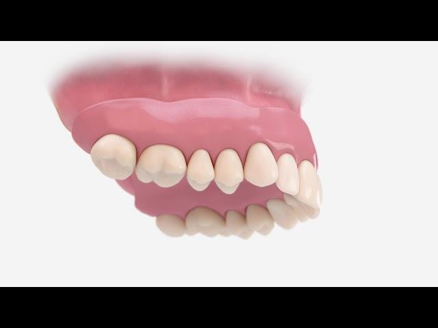 Atlantis Conus concept animation | Dentsply Sirona