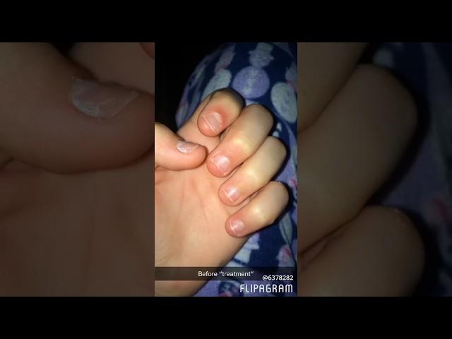 Nail growth journey 1// day 1 to 80