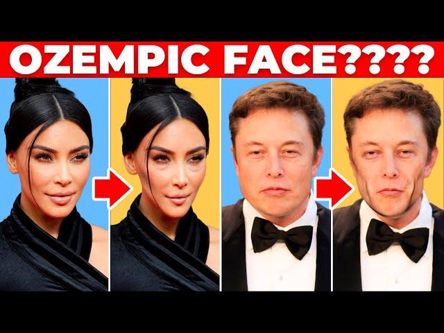 How Ozempic Can Make You Look OLDER! i.e. Ozempic Face or Wegovy Face