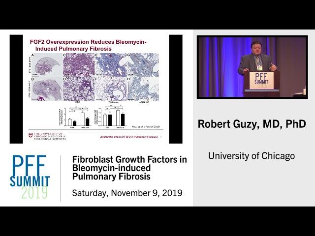 Fibroblast Growth Factors in Bleomycin-induced Pulmonary Fibrosis | Robert Guzy, MD