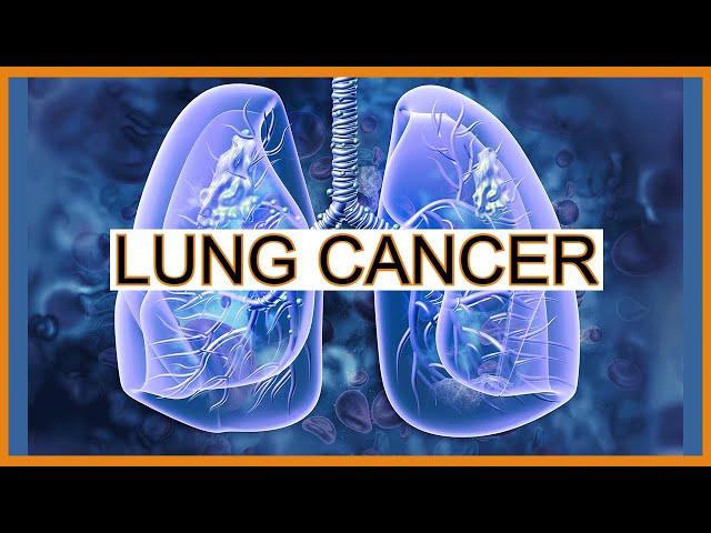 Lung Cancer/Tumors