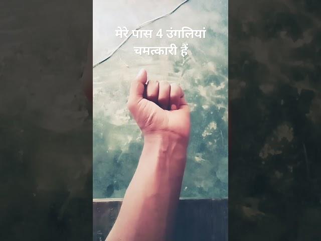 I have 4 finger #finger #hand #shorts