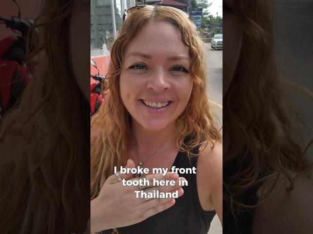 When a broken tooth becomes normal.