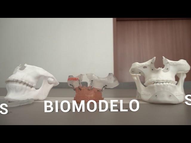 Produtos médicos CPMH com impressão 3D