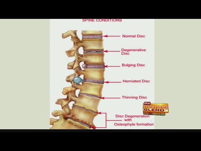 AZ Pain Centers - relief from activity related pain