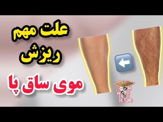 علت ریزش موهای ساق پا و براق شدن پوست پا چیست؟