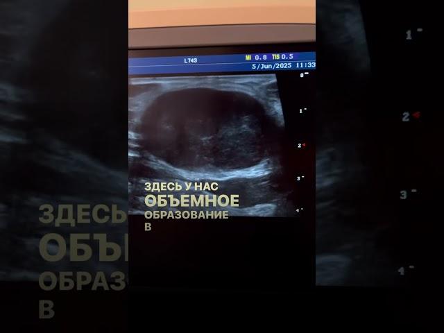 #доктор #узи #опухоль #девочка #кормление #кормлениегрудью #беременность #здоровье