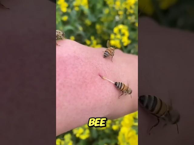 What to do if a bee stings you 
