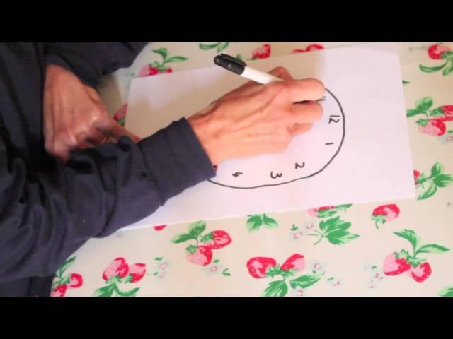 Clock drawing test dementia