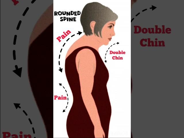 Correct your Rounded Spine Posture #shorts