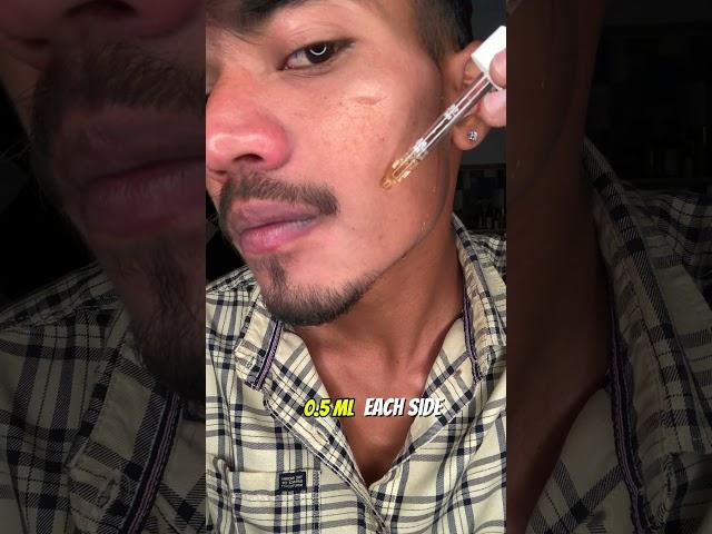 Day 15 Of Using Man Matters Minoxidil 5% for Beard Growth  #beardgrowth #minoxidilresult #viral