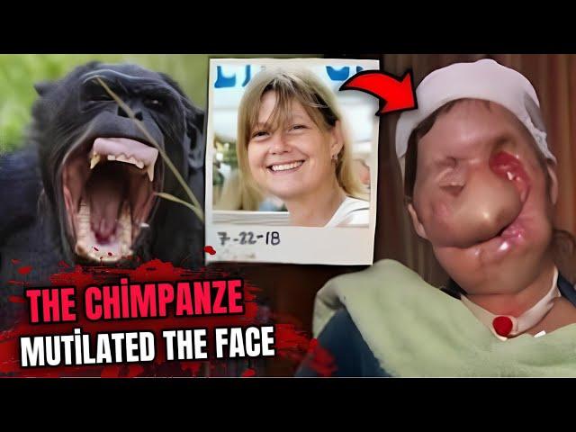 The Tragic Story of Charla Nash, Maimed by a Chimpanzee