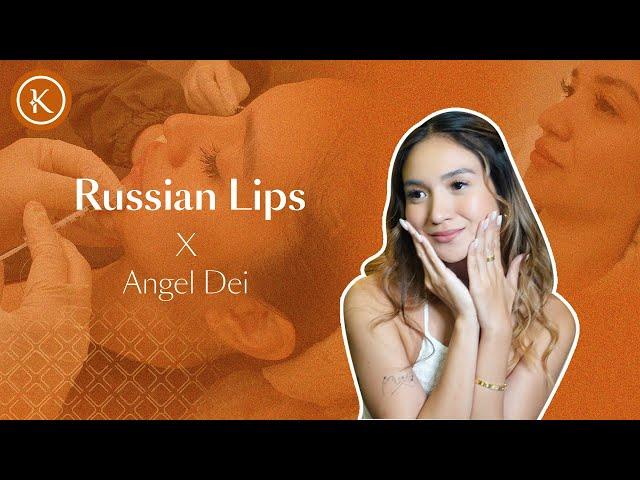 Russian Lips x Angel Dei