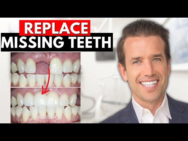 How to Replace Missing Teeth