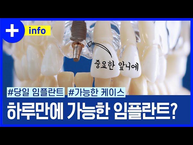 하루 만에 가능한 발치 당일, 즉시 임플란트, 원데이 임플란트가 무엇인지? 아무나 가능할까?