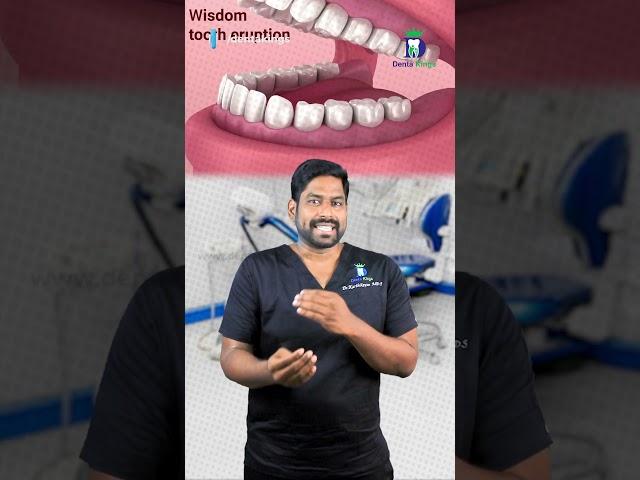 எது ஞானப்பல்? How to identify wisdom tooth? | Dr. Karthikeyan | Denta Kings