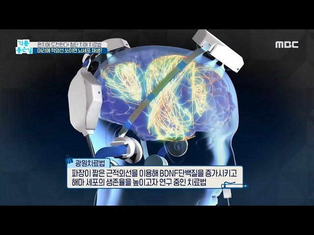 [HEALTHY] Infrared light on the head slows Alzheimer's progress?, 기분 좋은 날 20200918