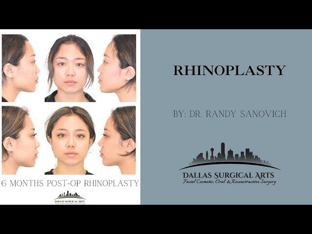 A Look Inside The OR: Rhinoplasty Surgery at Dallas Surgical Arts