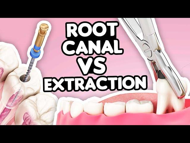 Root Canal vs. Tooth Extraction: What’s the Right Choice?