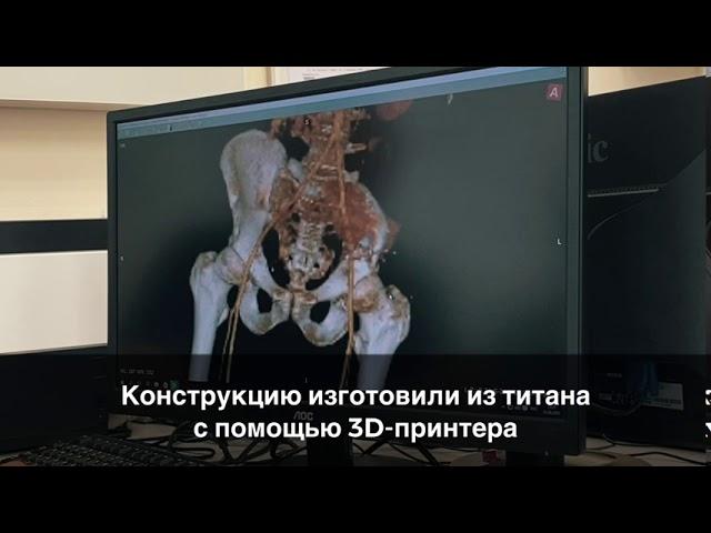 Врачи НМИЦ онкологии им. Н.Н. Петрова спасли ногу пациенту с диагнозом остеосаркома