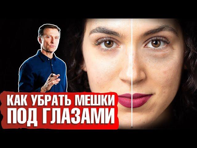 Мешки под глазами: как убрать? Какая причина отека под глазами? 