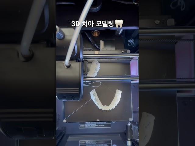 3D 치아 모형 만드는 방법 #3d프린터