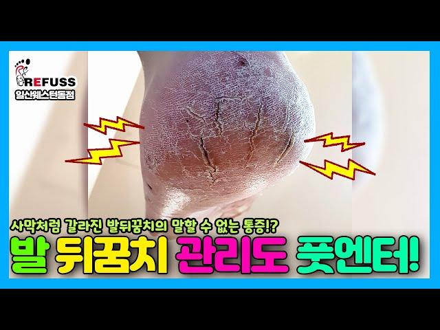 발 뒤꿈치 관리도 풋엔터테인먼트에서!! 사막의 땅처럼 갈라진 발뒤꿈치의 말할수 없는 통증 관리하기! #레푸스 #레푸스일산 #내성발톱 #일산각질 #일산발각질 #toenail #발톱