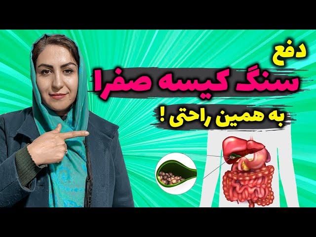 دفع سنگ کیسه صفرا بدون عمل جراحی: نسخه ای شگفت انگیز برای دفع سنگ کیسه صفرا