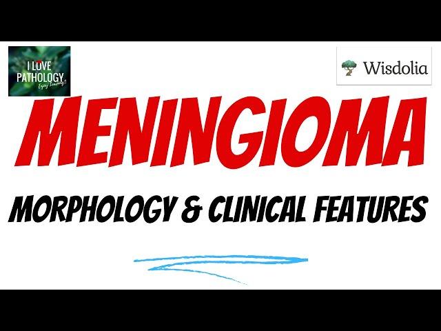 MENINGIOMA  | Part 2 | Histopathology | Clinical features| Treatment& prognosis