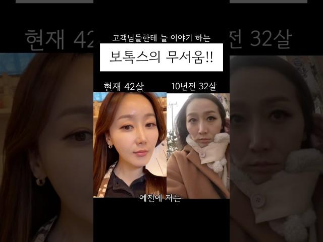 보톡스의 무서움!