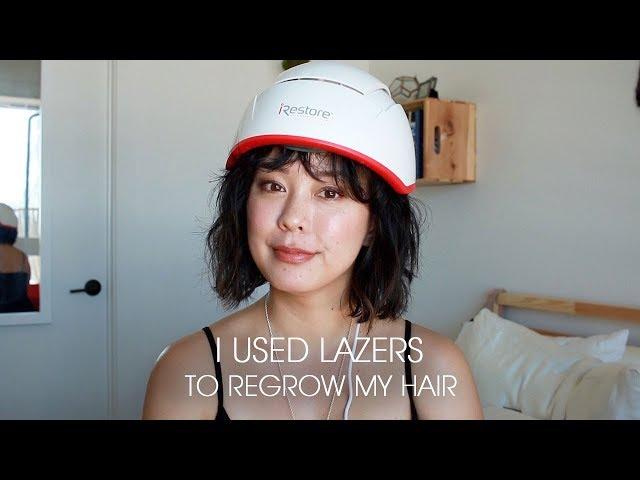 hair regrowth for hair loss and thinning hair | iRestore Professional