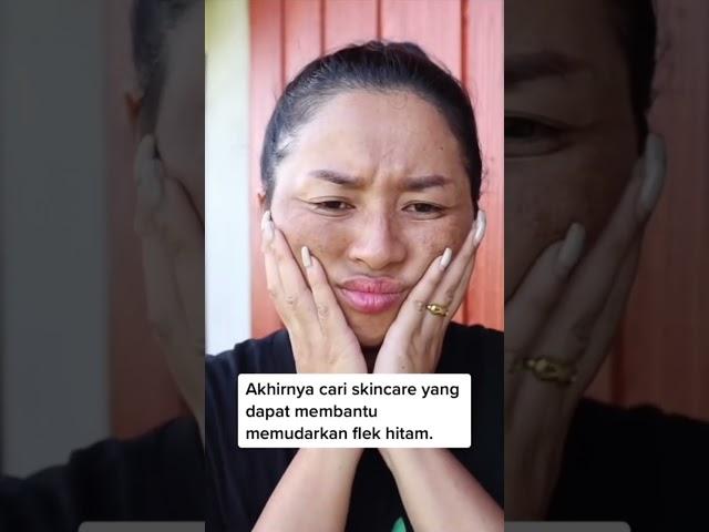 Akibat Pakai Skincare Yang Mengandung Merkuri