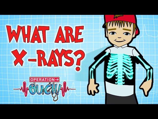 How do X-Rays Work? | Broken Bones | Operation Ouch