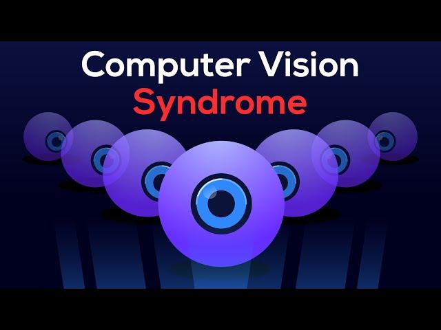 How I CURED my EYE STRAIN (Relief from Computer Vision Syndrome )