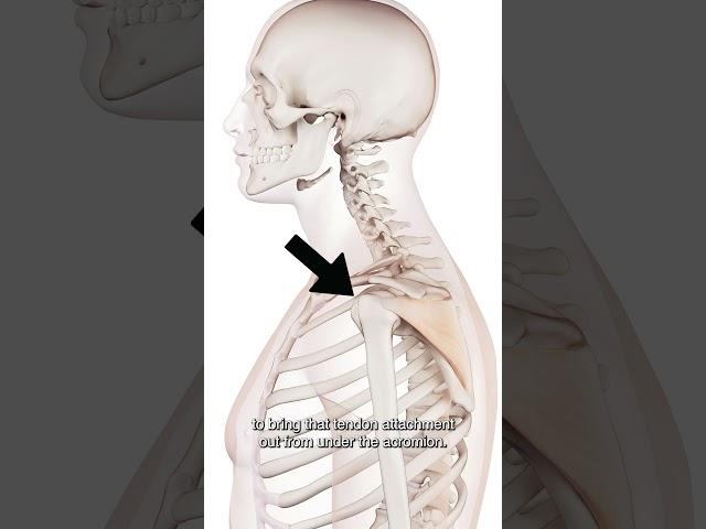 How Do You Find The Infraspinatus Muscle?