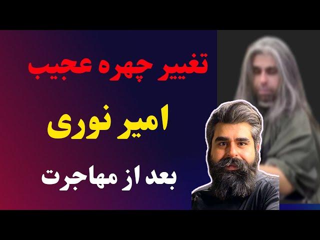 تغییر چهره عجیب و شوکه کننده امیر نوری بعد از مهاجرت