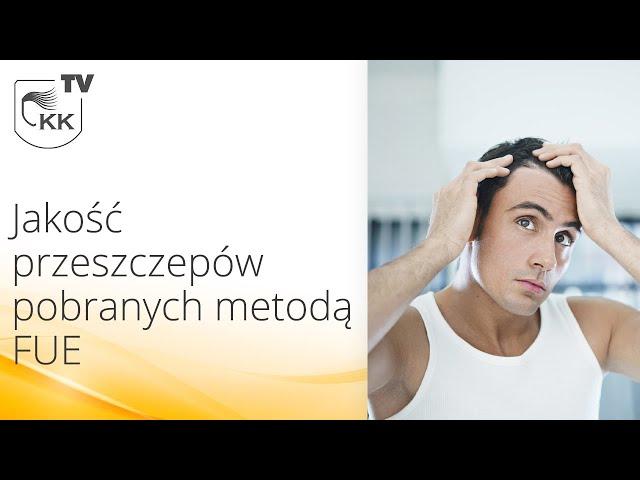 Przeszczep włosów FUE - Jakość przeszczepów pobranych metodą FUE