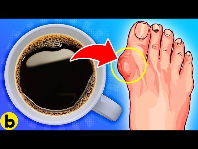 EAT This, NOT This If You Have Gout