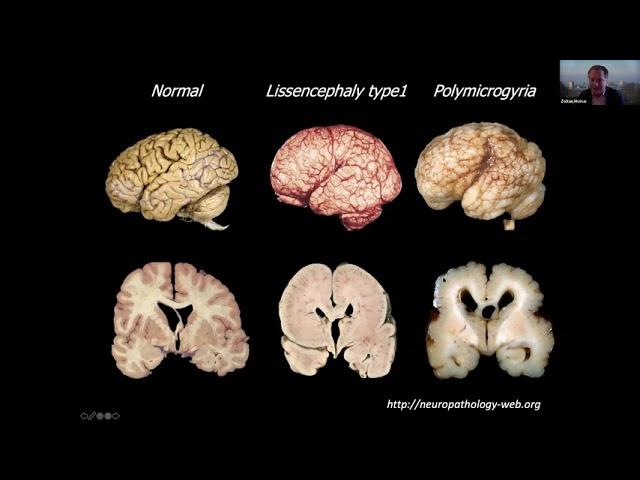 Dr. Zoltán Molnár: "Repurposed Cells Of Development In The Adult Brain”.